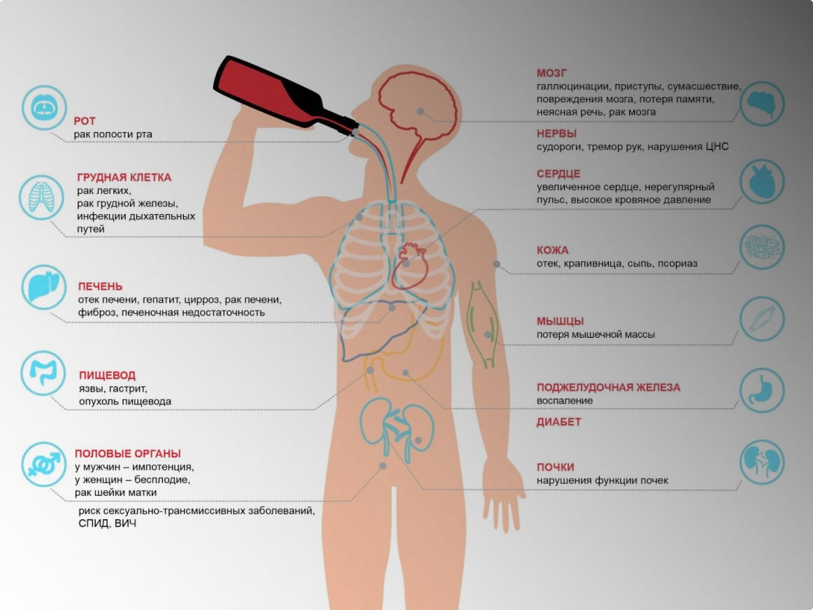 симптомы алкогольного опьянения схематично